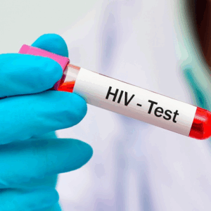 Anticuerpos ANTI HIV 1/2
