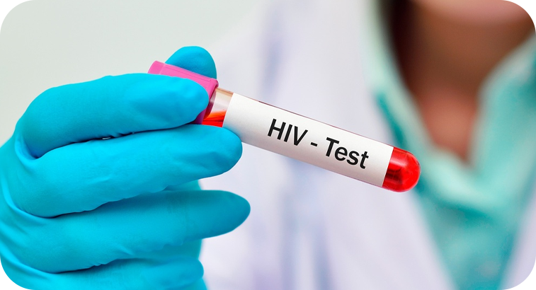 Anticuerpos ANTI HIV 1/2