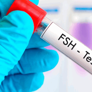 FSH (Hormona Folículo Estimulante)