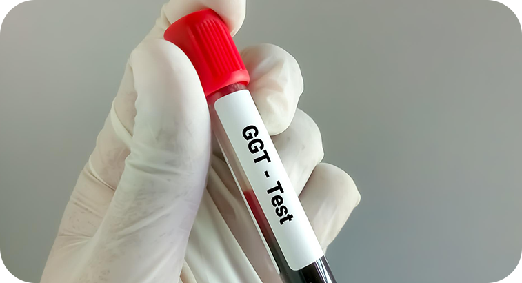 GGT (Gamma Glutamil Transferasa)