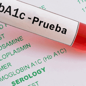 Hemoglobina Glucosilada (HbA1c)