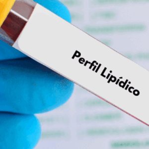 Perfil de Lípidos