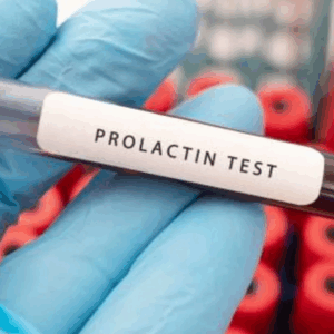 Prolactina
