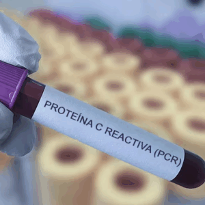 Proteína C Reactiva (PCR)