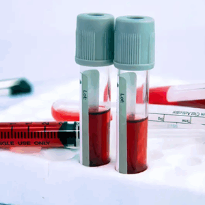 Química Sanguínea (6)