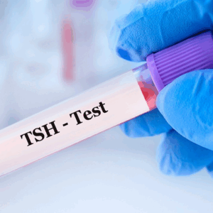 TSH (Hormona Estimulante de Tiroides)