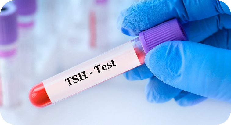 TSH (Hormona Estimulante de Tiroides)