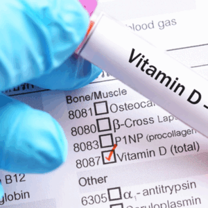 Vitamina D3 (25-Hidroxi)