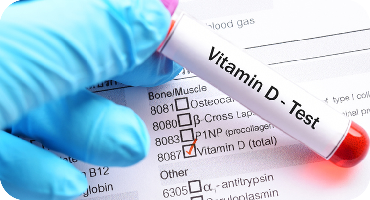 Vitamina D3 (25-Hidroxi)