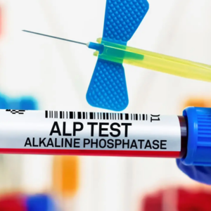 ALKP Fosfatasa Alcalina