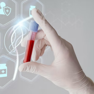 Anticuerpos Anti Beta 2 Glicoproteína 1 IgG/IgM
