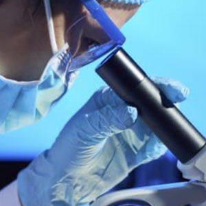 Anticuerpos Antiperoxidasa