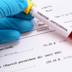 Anticuerpos Anti Receptor de TSH
