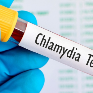Anticuerpos Anti Chlamydia Trachomatis IgG, IgM