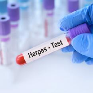 Anticuerpos Anti Herpes 2 IgM
