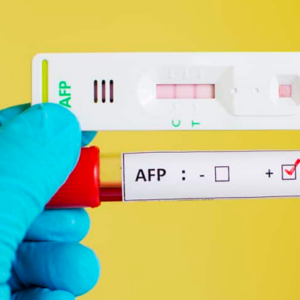 Alfafetoproteina AFP