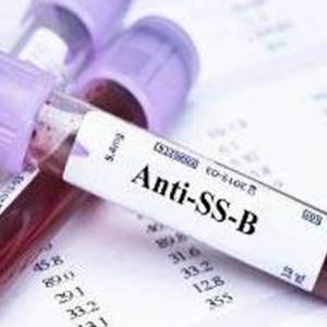 Anticuerpos Anti SSA/SSB (Ro/La)