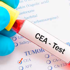 Antígeno Carcinoembrionario CEA