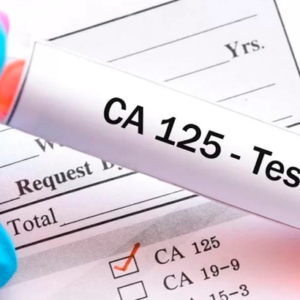 CA 125