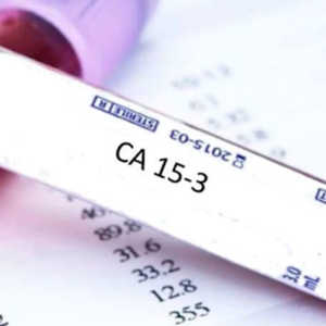 CA 15.3