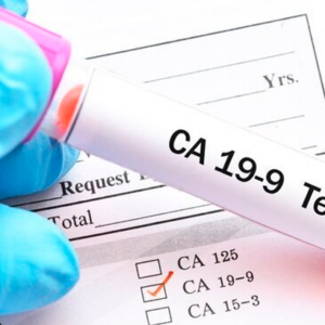CA 19.9