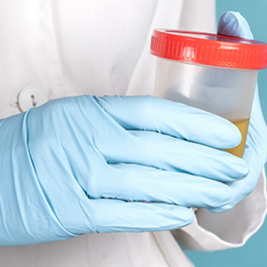 Citología de Moco Fecal