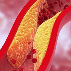 Colesterol HDL