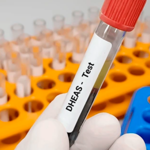 Dehidroepiandrosterona Sulfato DHEAS