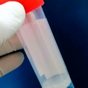 Espermatobioscopia