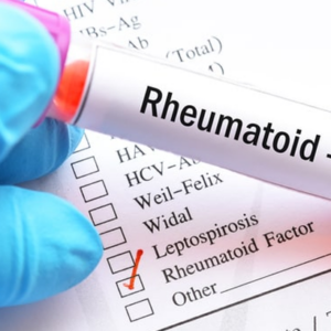 Factor Reumatoide FR