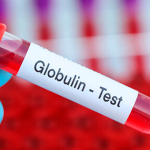Globulina