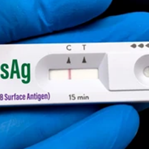 Hepatitis B AG Australia HBSAG