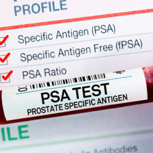 PSA Libre (Antígeno Prostático Libre)