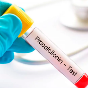 Procalcitonina