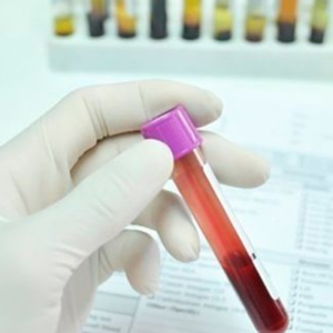 Proteínas Totales Séricas