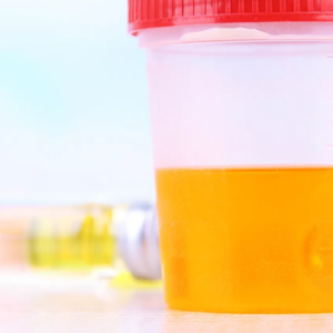 Proteinuria 24 hrs- Frasco
