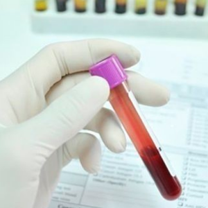 Química Sanguínea 30 QS30