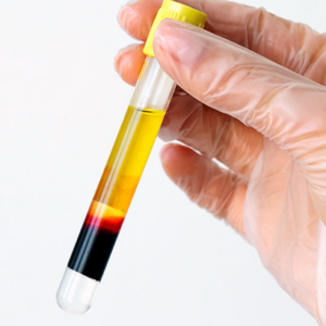 Química Sanguínea 45 QS45