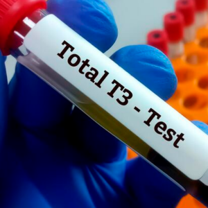 T3 Total (Triyodotironina Total)