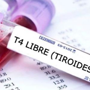 T4 Libre (Tiroxina Total)