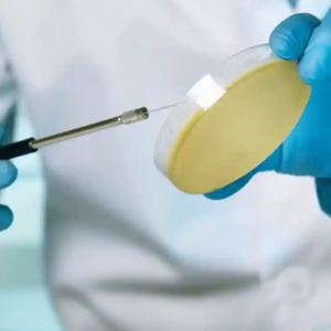Urocultivo