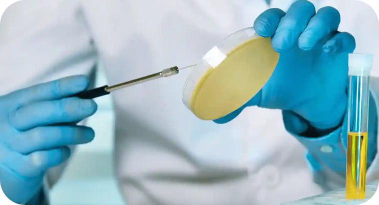 Urocultivo