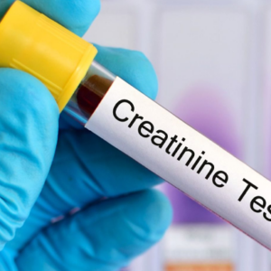 Creatinina