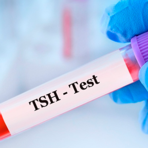 Perfil Tiroideo Parcial (TSH, T4, T3)