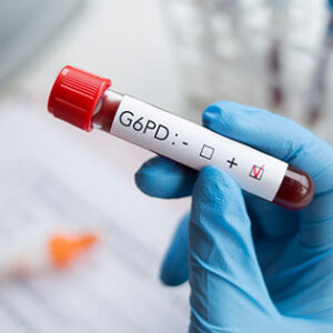 Glucosa 6 Fosfato Deshidrogenasa