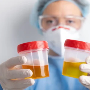 Proteínas Totales en orina de 24 hrs