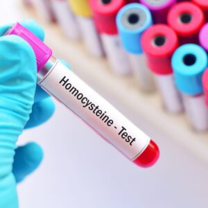Homocisteina (HC)